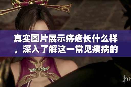 真实图片展示痔疮长什么样，深入了解这一常见疾病的表现特点