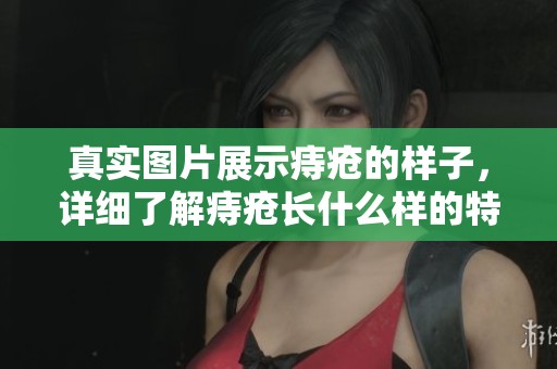 真实图片展示痔疮的样子，详细了解痔疮长什么样的特点和表现
